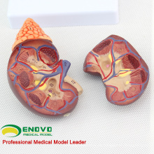 VERKAUF 12433 Life Size Normal Nieren-Anatomie-Modell, Anatomie Urinary Nierenmodell